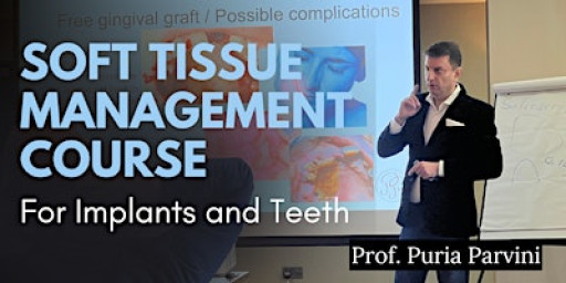 Soft Tissue Management for Implants & Teeth